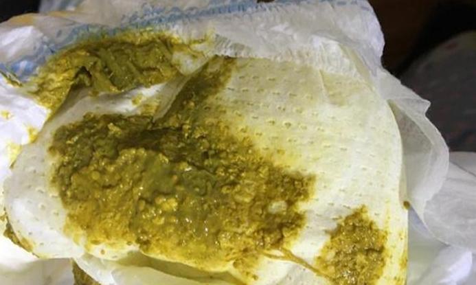 去除大便黄渍小窍门大集合