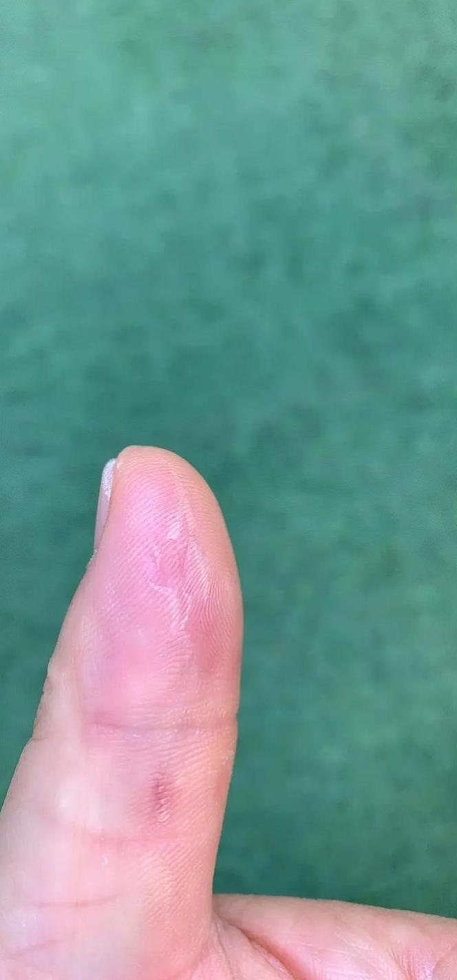 玻璃杯裂开的原因与预防措施